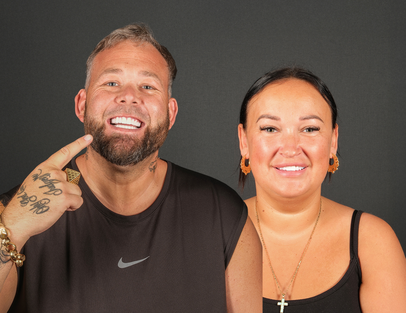 Dental treatment results in Turkey showing dental implants and smile makeover cases for UK patients