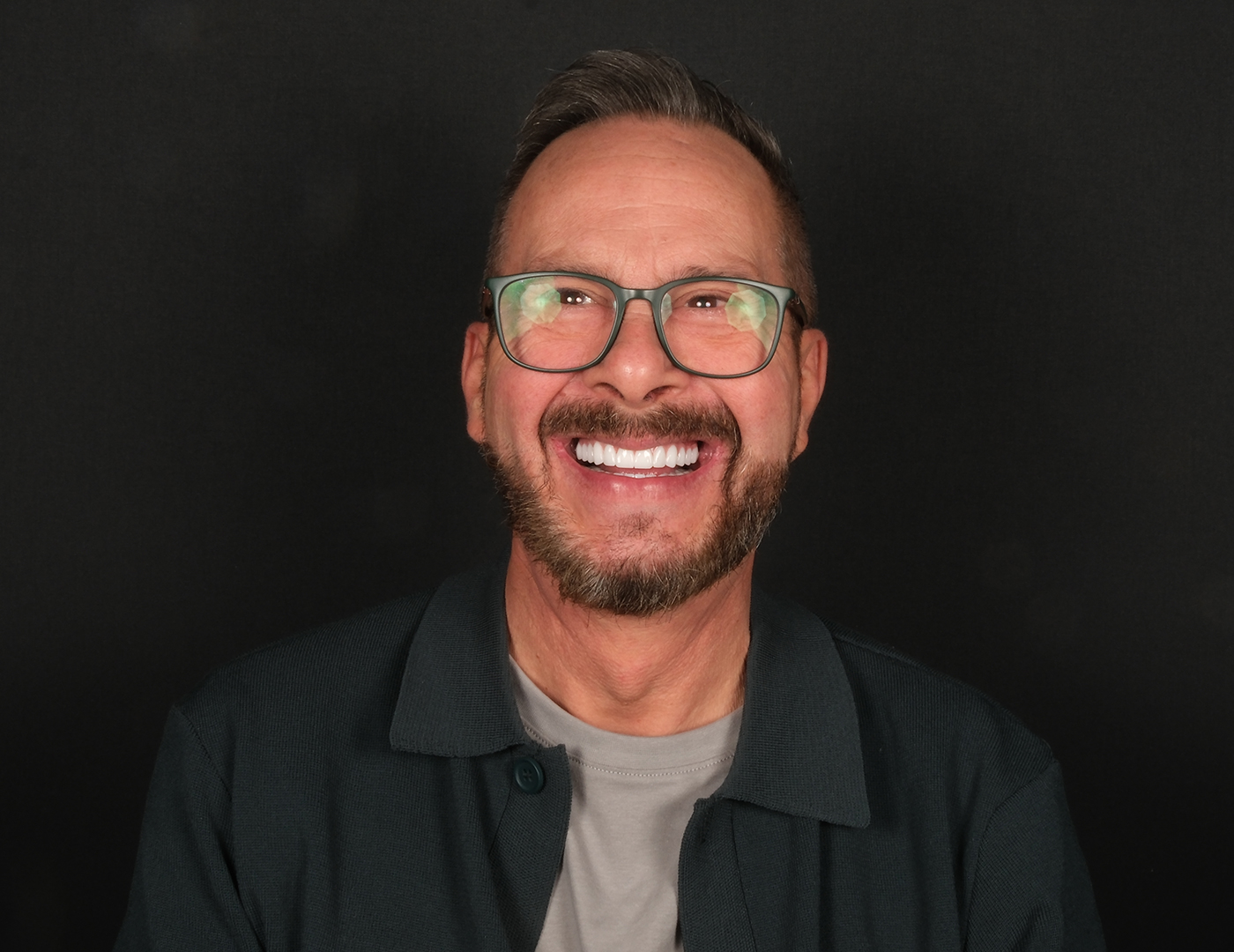 Full arch dental implants in Turkey showing All on 5 implant case for UK patient